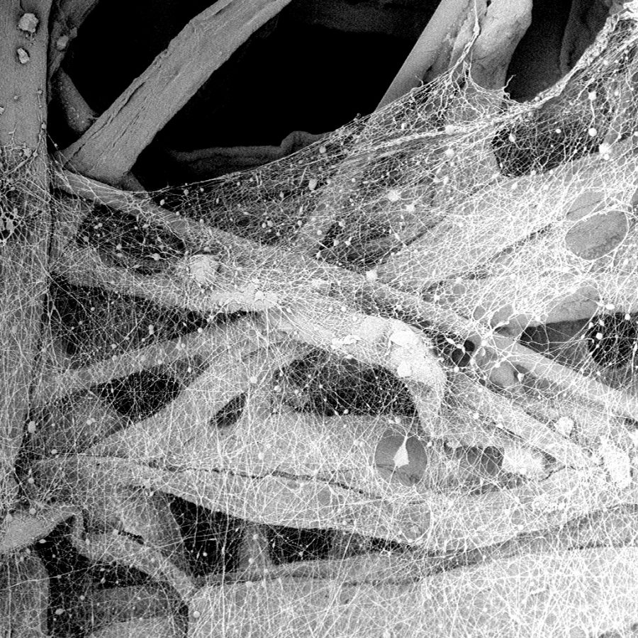 用扫描电子显微镜观察到有缺陷的脉冲清洗过的空气过滤器