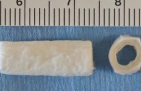 静电纺丝管状支架