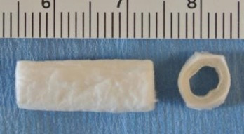 静电纺丝管状支架